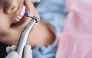 regular teeth cleaning is important for preventing teeth disease