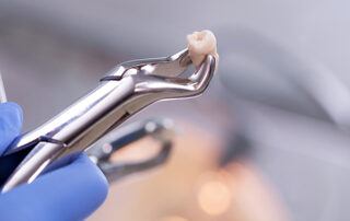 learn how to take care of your tooth after extraction