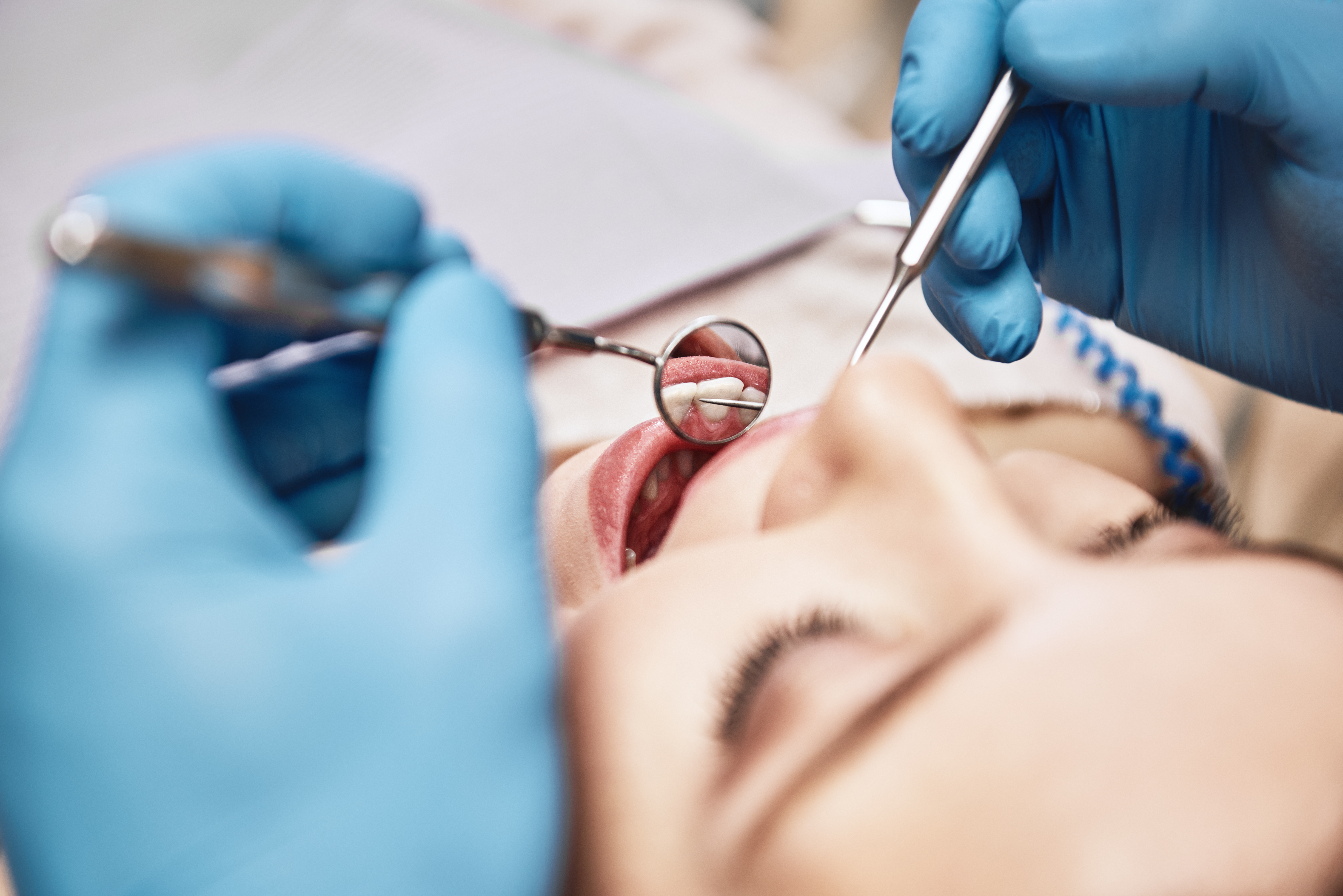 Timeline for Permanent Tooth Eruption