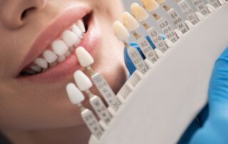 dental crown material